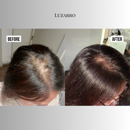 Luzarro Natural Hair Growth Treatment
