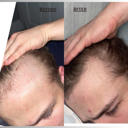 Luzarro Natural Hair Growth Treatment