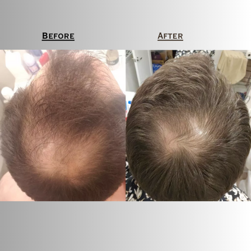 Luzarro Natural Hair Growth Treatment